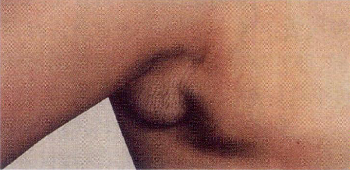 (一)胚胎期乳腺發(fā)育